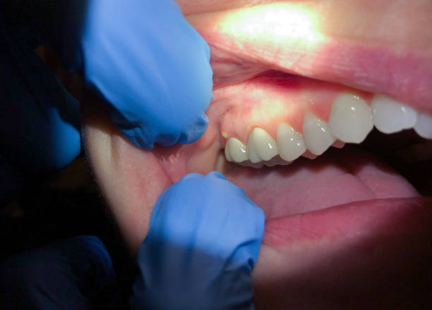 Best After-Hours Emergency Dentist in Athens, MI